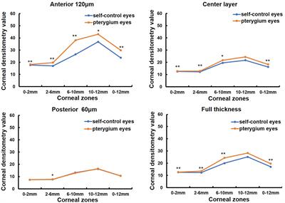 The influence of pterygium on corneal densitometry evaluated using the Oculus Pentacam system